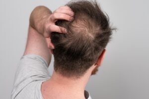 hair-thin