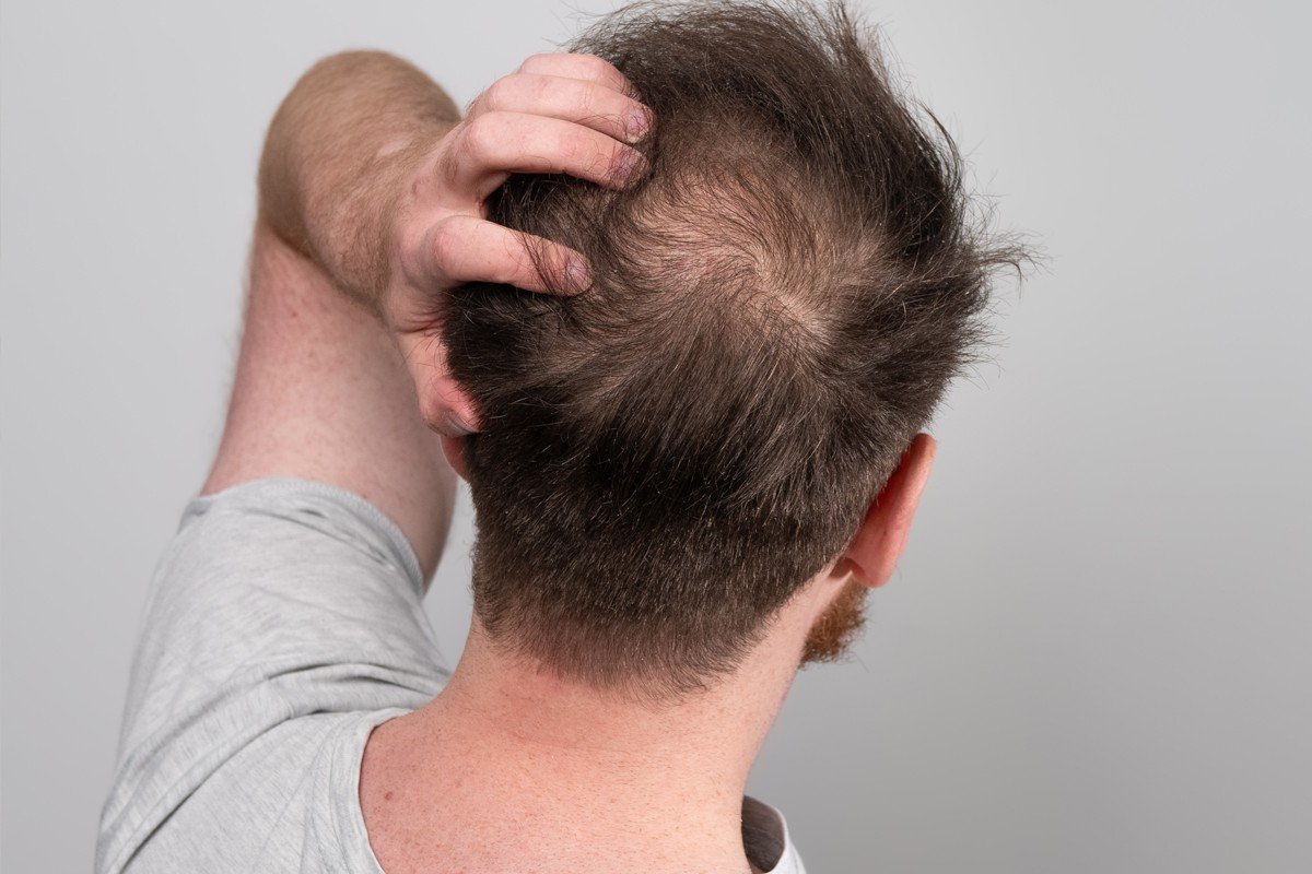 hair-thin